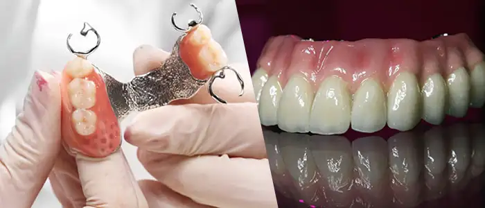 protesis removibles dentales tratamiento